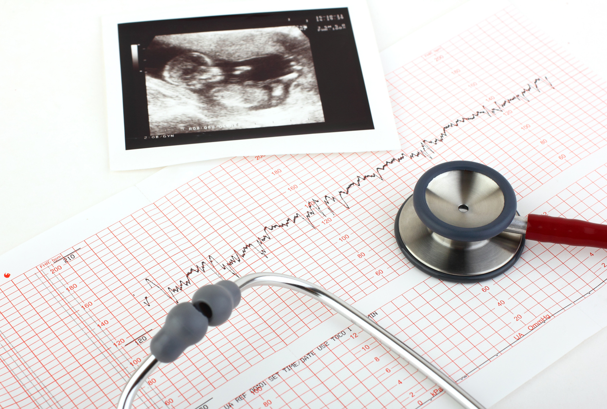 birth injury lawyer fetal monitoring solved